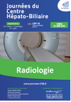 Programme Journée de Radiologie Hépato-Biliaire 2013
