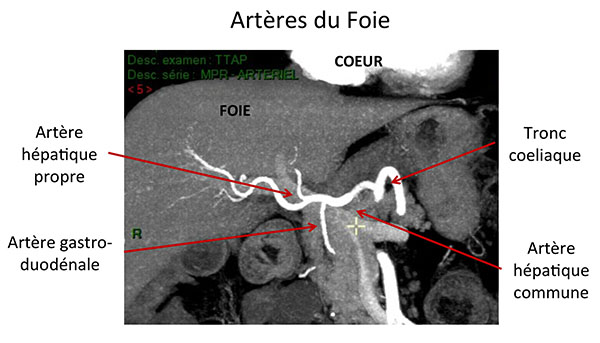 Le Foie et les Voies biliaires : Anatomie | Centre Hépato-Biliaire ...