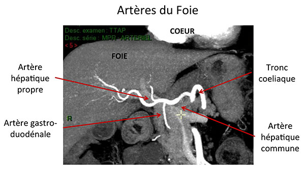 Le foie