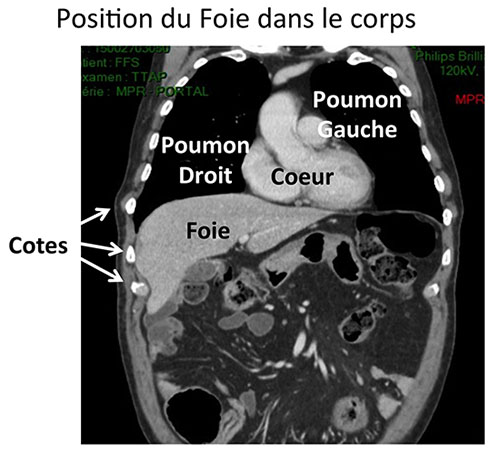 Le Foie et les Voies biliaires : Anatomie | Centre Hépato-Biliaire ...