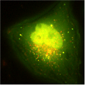 INSERM Unit 1193 - Photo Couleur - Autophagie - Christian POUS