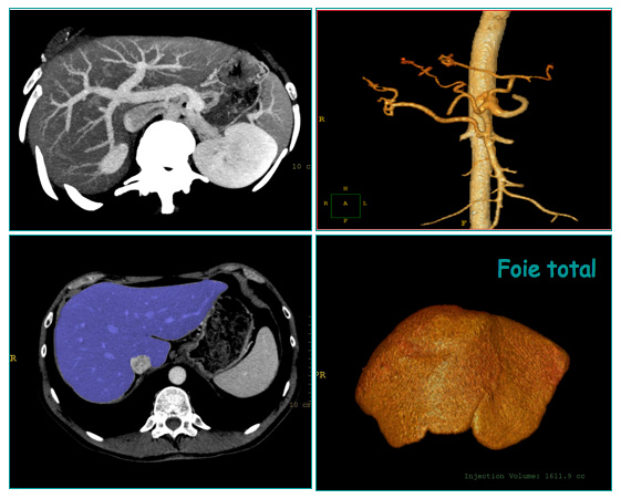 Le scanner - Centre Hypertension-Paris