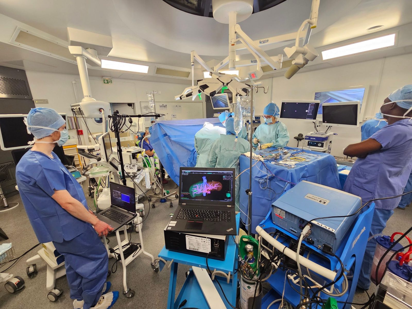 Chirurgie guidée par l'image : reconstruction 3D du foie affichée au bloc opératoire du Centre Hépato-Biliaire